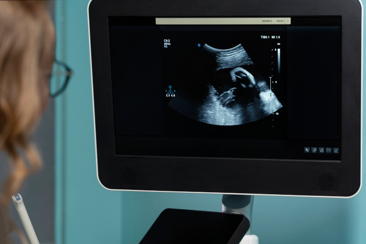 3D та 4D УЗД при вагітності в Харкові ⭐️ b-healthy clinic