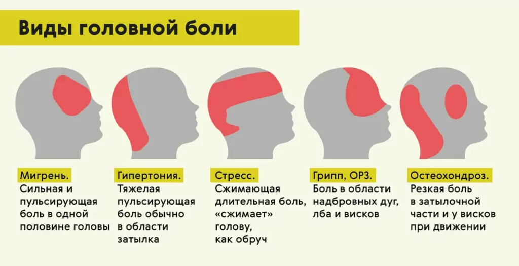 Види головного болю